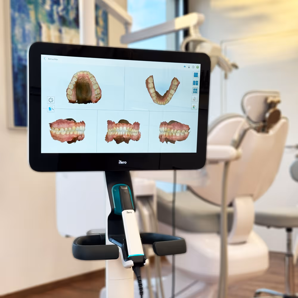 Zahnscanner iTero mit 3D-Bildern von Z&auml;hnen auf dem Bildschirm in einer Zahnarztpraxis.