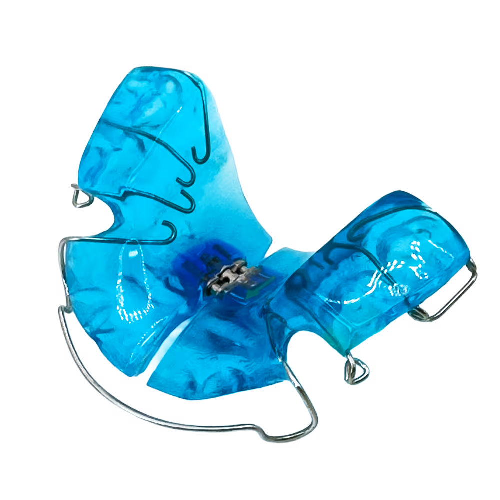 Blaue herausnehmbare Zahnspange mit Drahtb&uuml;geln.