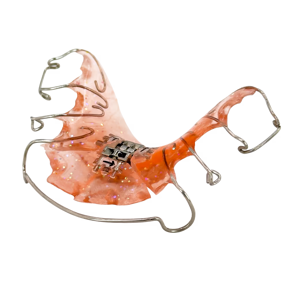 Orange herausnehmbare Zahnspange mit Metallklammern und Schraube zur Anpassung.
