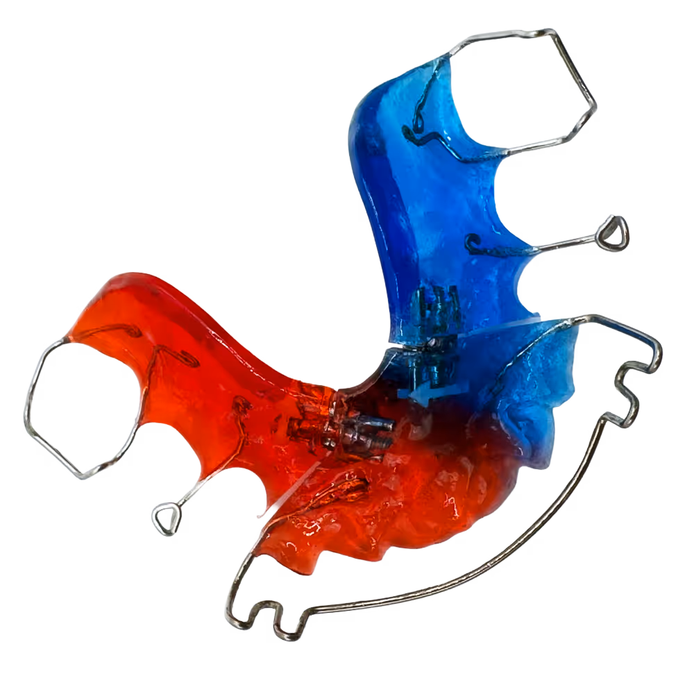 Bunte herausnehmbare Zahnspange mit roten und blauen Kunststoffteilen und Metallb&uuml;geln.