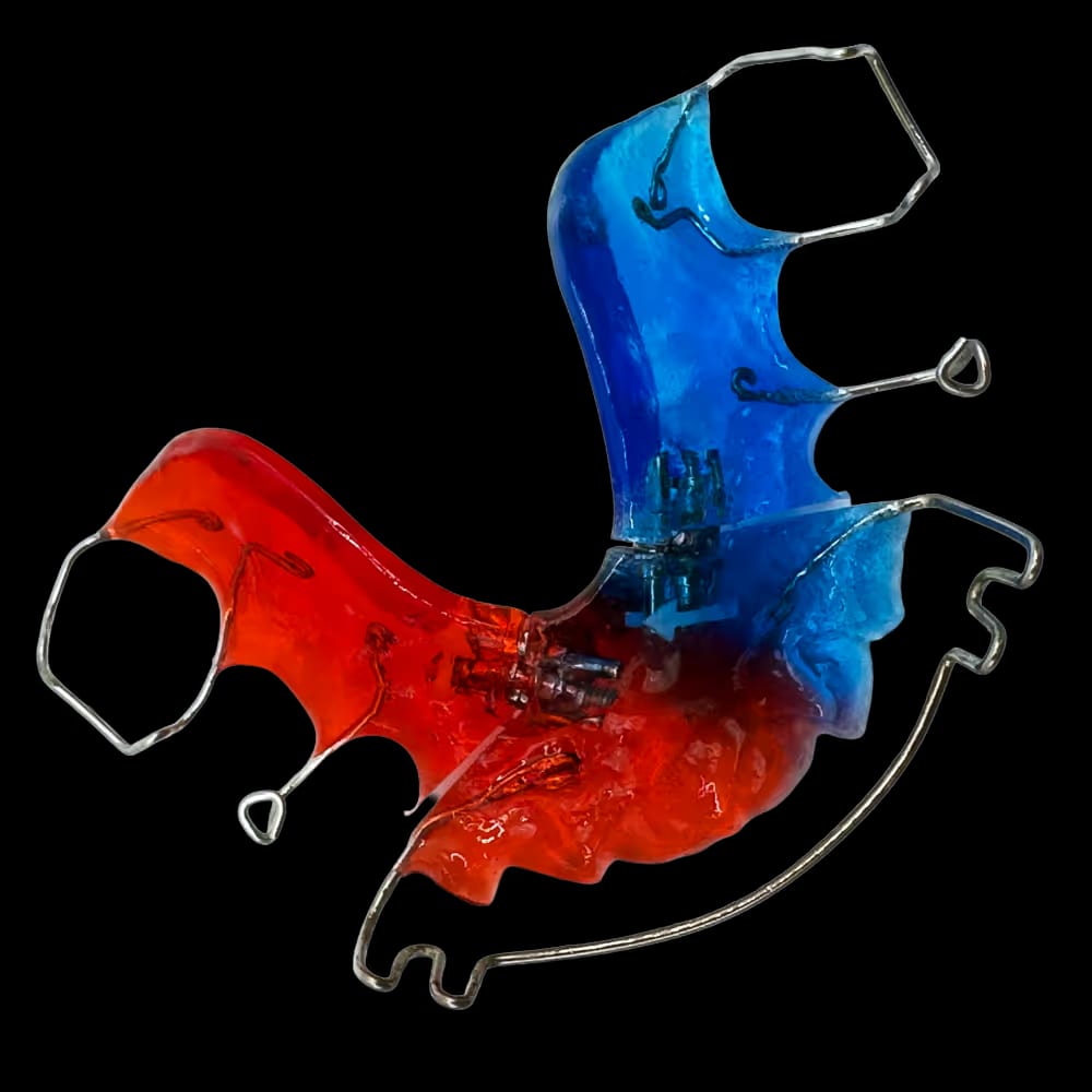 Bunte herausnehmbare Zahnspange mit roten und blauen Kunststoffteilen und Metallbügeln.