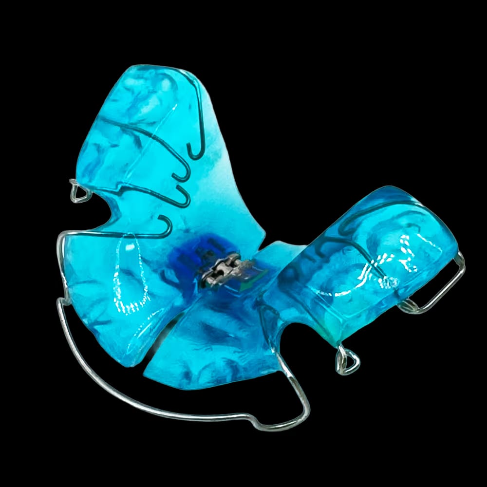 Blaue herausnehmbare Zahnspange mit Drahtbügeln.