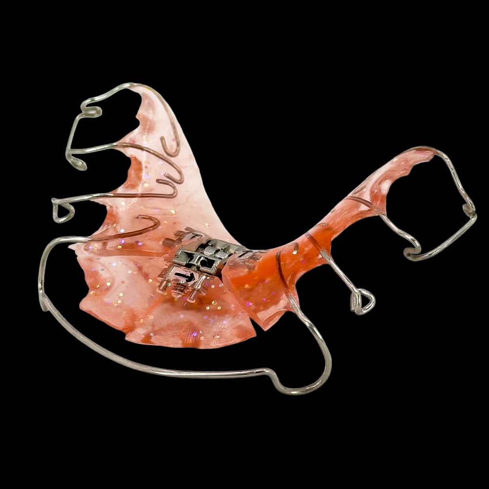 Orange herausnehmbare Zahnspange mit Metallklammern und Schraube zur Anpassung.